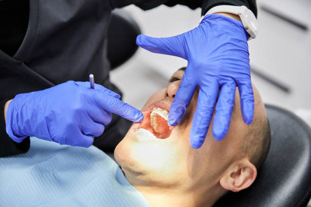 Best Emergency Dental Care for Broken or Chipped Teeth in Helena, AL