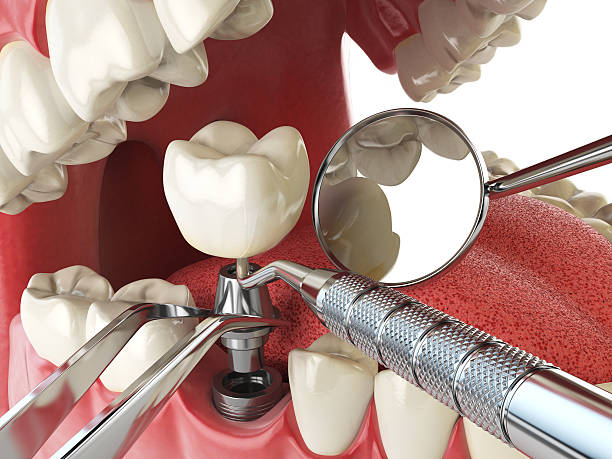 Best Same-Day Emergency Dental Services in Helena, AL