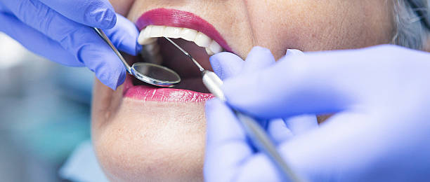 Best Emergency Dental Care for Broken or Chipped Teeth in Helena, AL